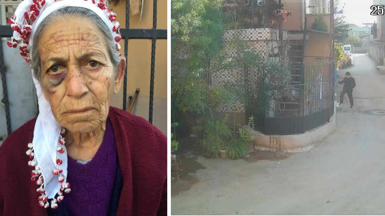 Kanser hastası yaşlı kadını dakikalarca dövüp gasp etti