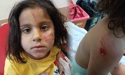 Başıboş köpeklerin saldırısına uğrayan çocuk yaralandı! Kuduz aşısı yapılarak taburcu edildi