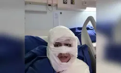 Kadıköy'de akıl almaz olay! Genç kadın başka bir kadın tarafından ateşe verildi