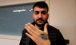 Güzellik merkezinde lazer skandalı elinden ediyordu