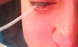 Çamaşır suyu gözüne sıçradı: Genç Anne görmesini kaybetti