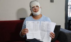 Adana'da Güzelleşmek uğruna gittiği merkezde yüzü yandı