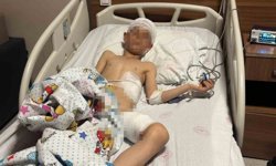 Van’daki köpek saldırsında kan donduran detaylar ortaya çıktı!