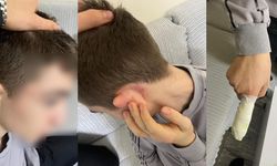 İstanbul'da hırsızlık yaptığını sanıp 14 yaşındaki çocuğu darp ettiler!