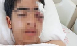 İstanbul'da 15 yaşındaki çocuk muştayla öldüresiye dövüldü