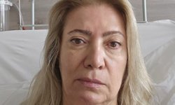 Güzellik vaadi kabusa döndü! 50 Bin Liraya Yüz Felci İddiası