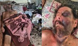 İzmir’de insanlık dramı: Darp edilip çöplerin arasında ölüme terk edildi!