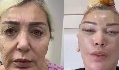 Gençleştirme operasyonu geçirmişti! Seda Sayan'ın görenler tanıyamadı