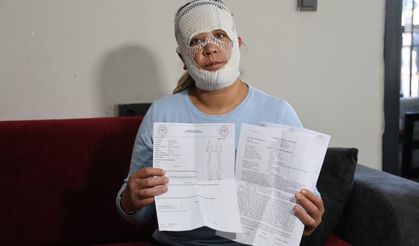 Adana'da Güzelleşmek uğruna gittiği merkezde yüzü yandı