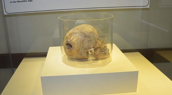 Samsun’da 3 bin yıllık kafatasındaki ameliyat izi görenleri şaşırtıyor