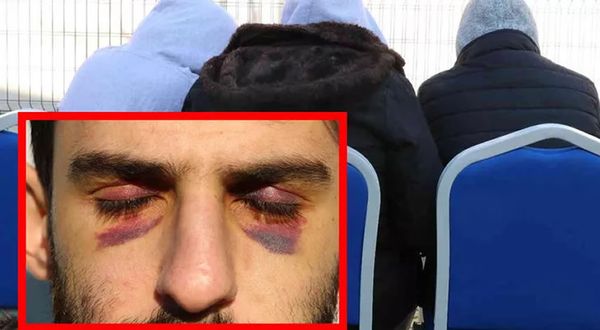 Yunan askerlerinden korkunç muamele! Dayak yiyenler nehri yüzerek Mehmetçiğe sığındılar