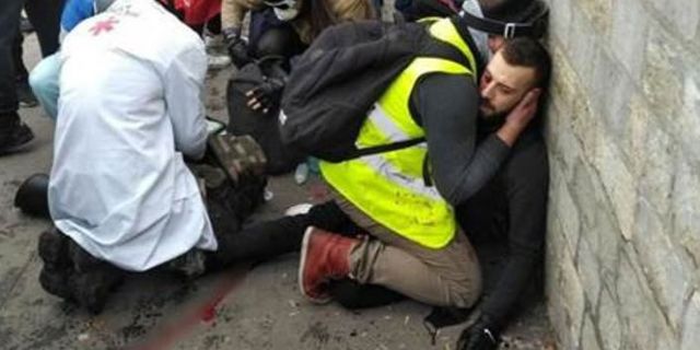 Paris sokakları karıştı! Bir kişinin kolu koptu
