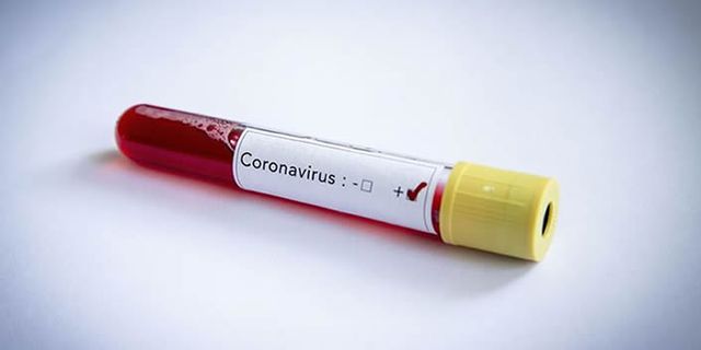 Önemli gelişme! Sağlık Bakanlığı, koronavirüsün yeni bir belirtisini açıkladı