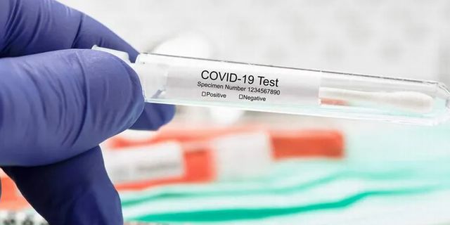 PCR testlerinde varyant endişesi
