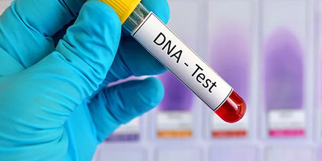 Türkiye'de bir ilk! 156 milyon TL'lik DNA testi