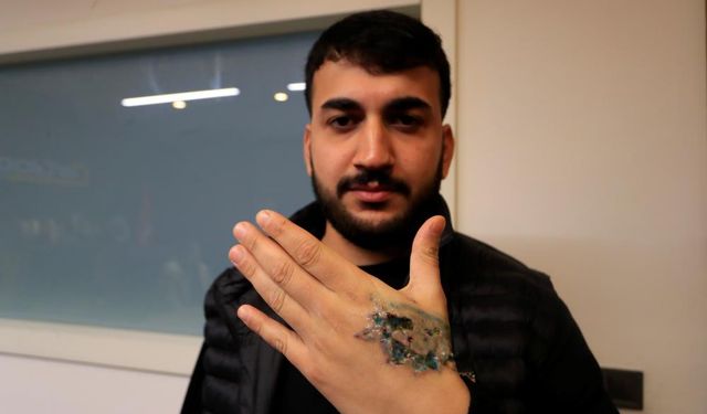 Güzellik merkezinde lazer skandalı elinden ediyordu