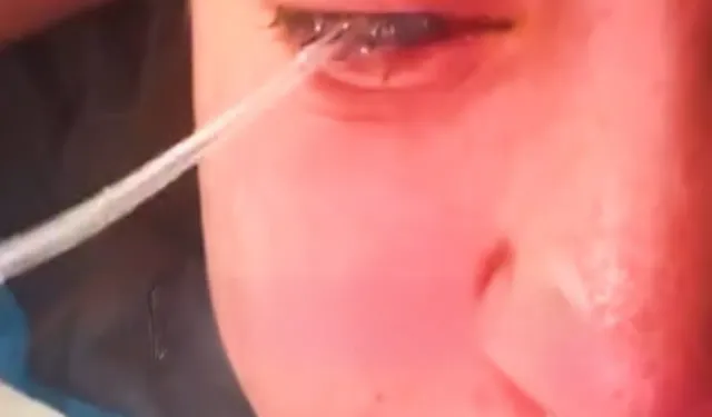 Çamaşır suyu gözüne sıçradı: Genç Anne görmesini kaybetti