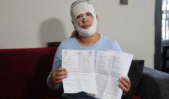 Adana'da Güzelleşmek uğruna gittiği merkezde yüzü yandı