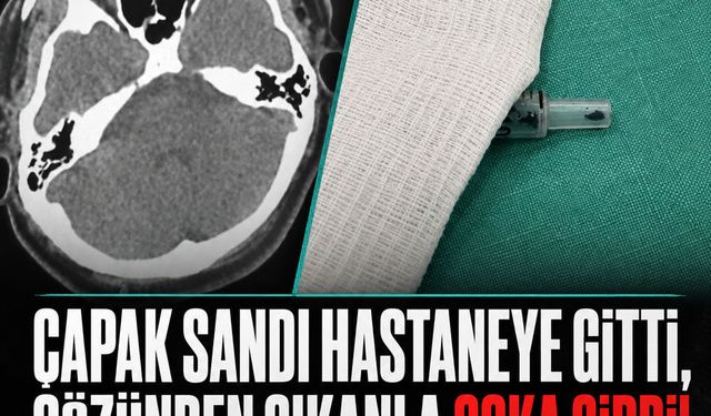 İstanbul'da akılalmaz olay: Matkaptan seken vida gözüne kaçtı