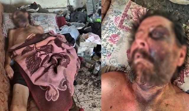 İzmir’de insanlık dramı: Darp edilip çöplerin arasında ölüme terk edildi!