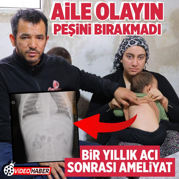 Kahramanmaraş'ta vücudundan zımba çıkan bebeğin ailesi sorumlulara ceza istedi