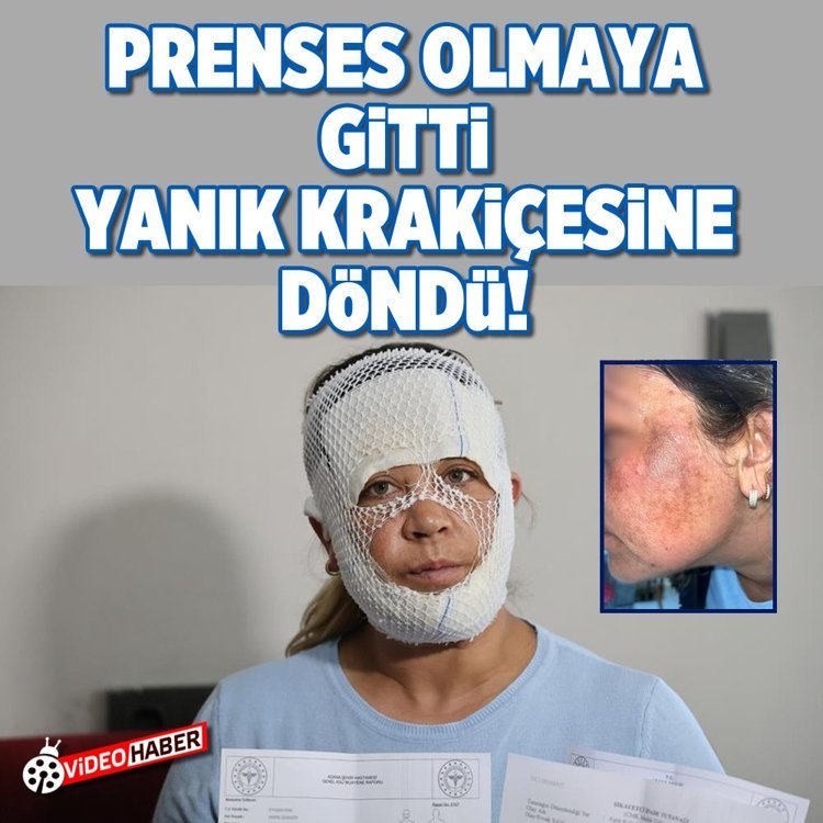 Adana'da Güzelleşmek uğruna gittiği merkezde yüzü yandı