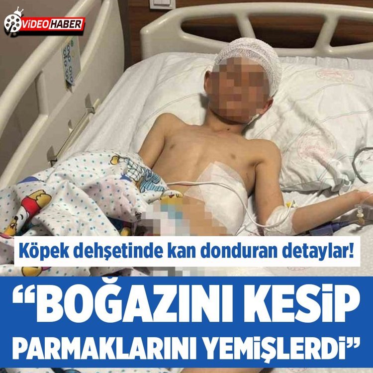 Van’daki köpek saldırsında kan donduran detaylar ortaya çıktı!