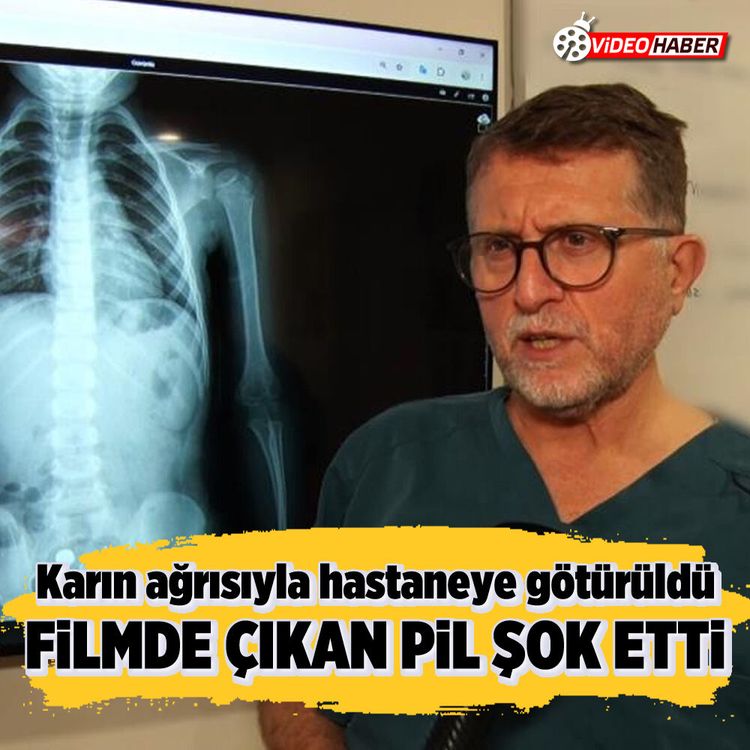 Karın ağrısıyla hastaneye götürüldü, filmde çıkan pil şok etti