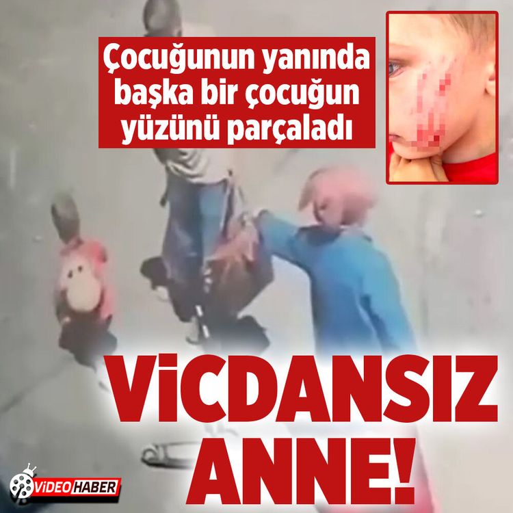Van'da bir anne çocuğunun yanında başka bir çocuğun yüzünü parçaladı! O anlar kamerada
