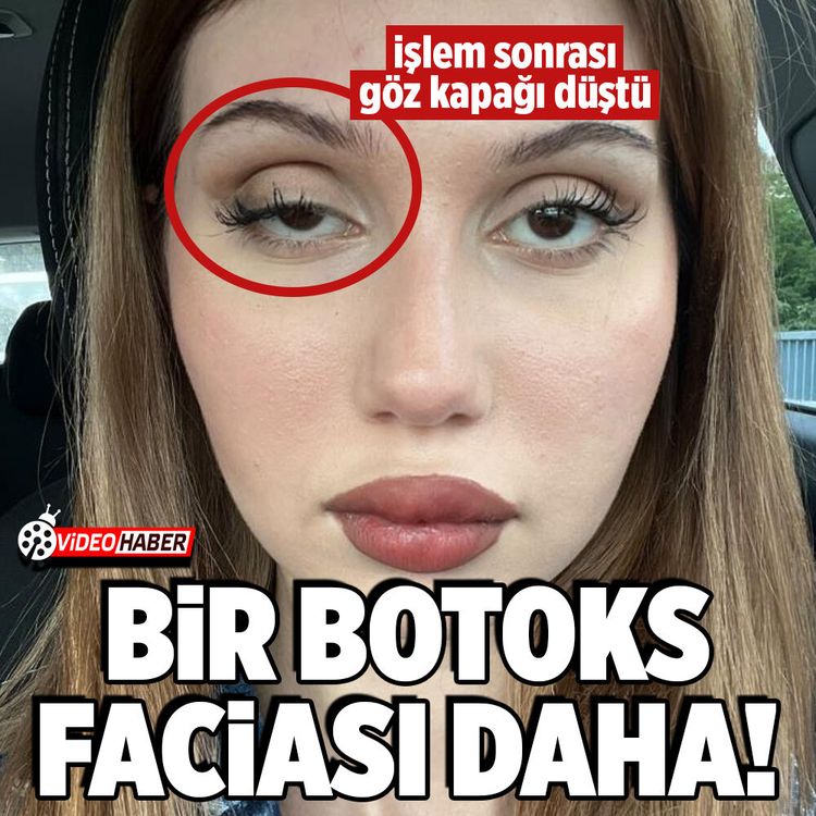 İstanbul'da botoks yaptıran kadının işlem sonrası göz kapağı düştü