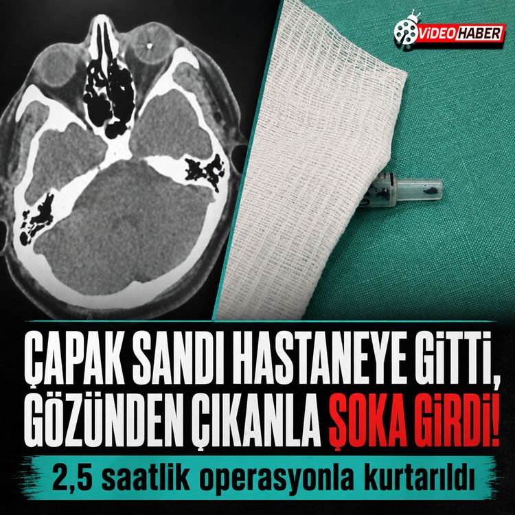İstanbul'da akılalmaz olay: Matkaptan seken vida gözüne kaçtı