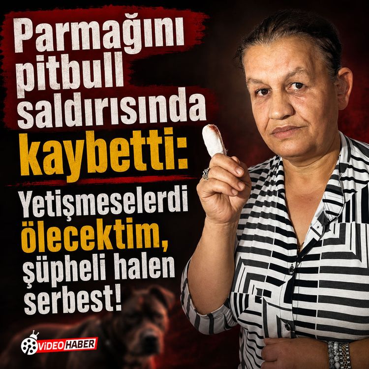 Parmağını pitbull saldırısında kaybetti: "Yetişmeselerdi ölecektim, şüpheli halen serbest!"