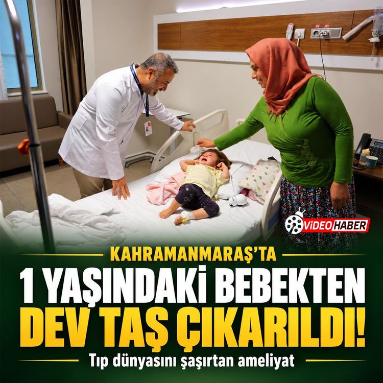 Kahramanmaraş’ta Tıp dünyasını şaşırtan ameliyat: 1 yaşındaki bebekten dev taş çıkarıldı!