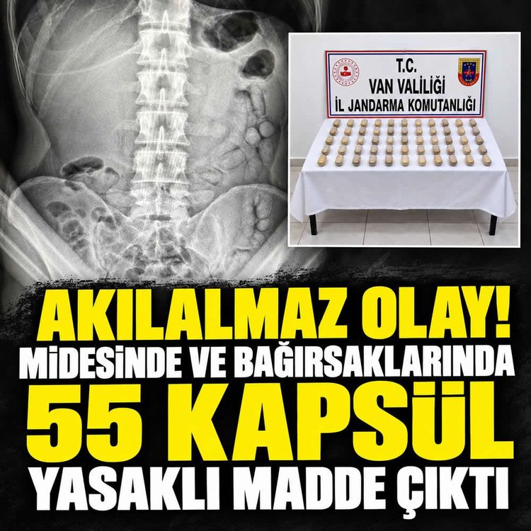 Midesinden ve bağırsaklarından 55 kapsül yasaklı madde çıktı!