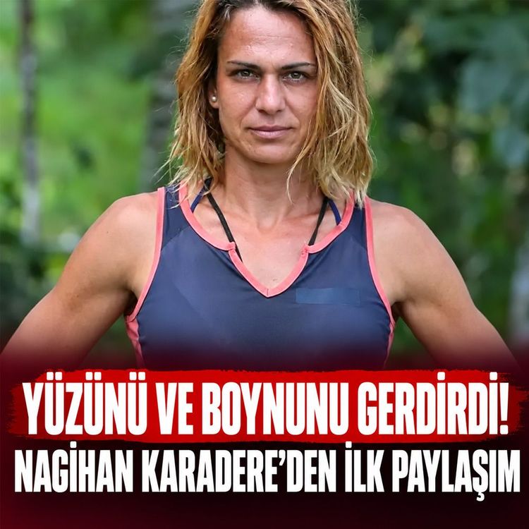 Yüzünü ve boynunu gerdirdi! Nagihan Karadere'den ilk paylaşım