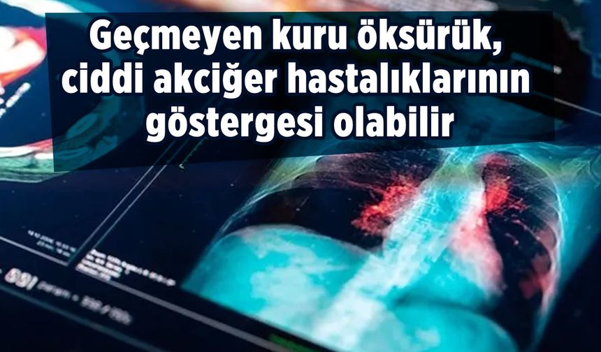 Uzmanı uyardı! Geçmeyen kuru öksürüğe dikkat