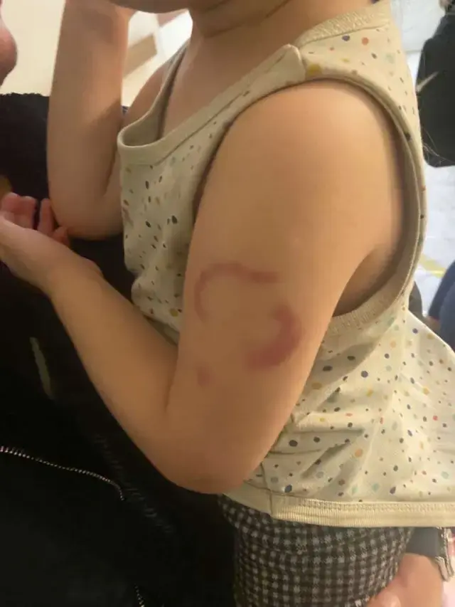 Isırıkogretennn (1)