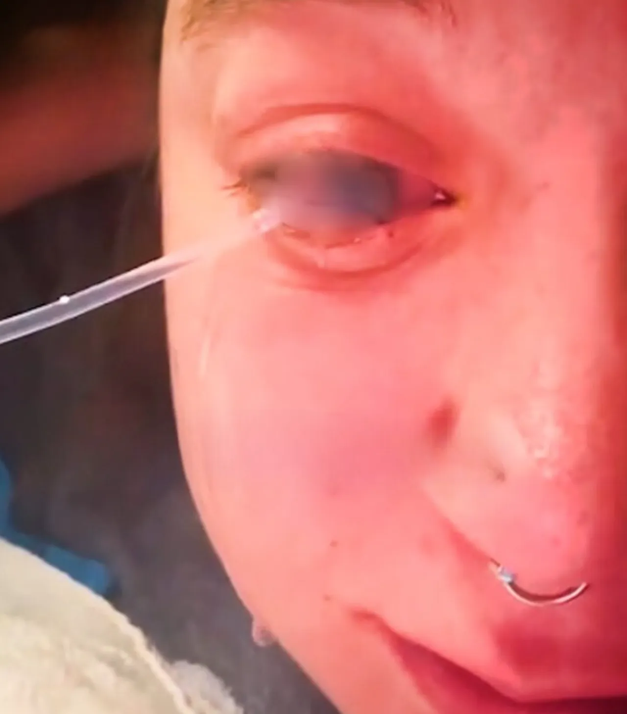 Sabah Uyandi Neye Ugradigini Sasirdi Bir Damla Camasir Suyu Gozunden Etti 1762759 202601121258 20260112125802 2