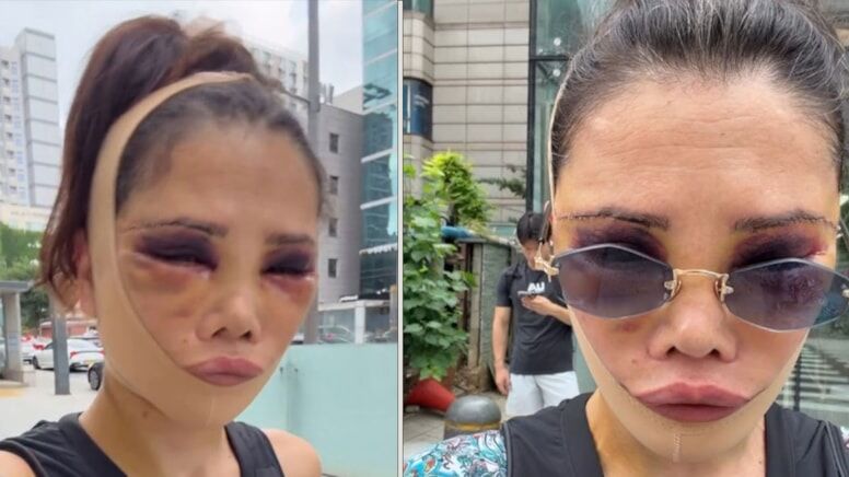 Didem Ceran Kimdir Kac Yasinda Ve Nereli Son Halini Paylasip Adeta Ates Puskurdu